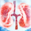 8 พฤติกรรมเสี่ยง ต้องระวัง! “โรคไต”