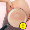 Pregnant? Watch out for rose rash this rainy season!