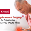 Knee Replacement Surgery Is Not As Frightening As You Would Think.