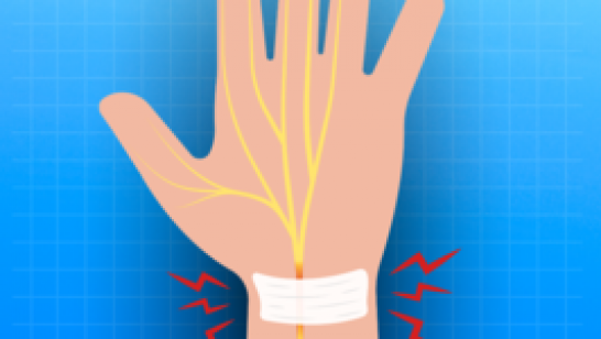 ใช้ข้อมือหนัก เช็กด่วน! อาการเสี่ยงโรคพังผืดข้อมือ