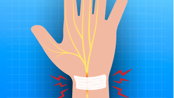ใช้ข้อมือหนัก เช็กด่วน! อาการเสี่ยงโรคพังผืดข้อมือ