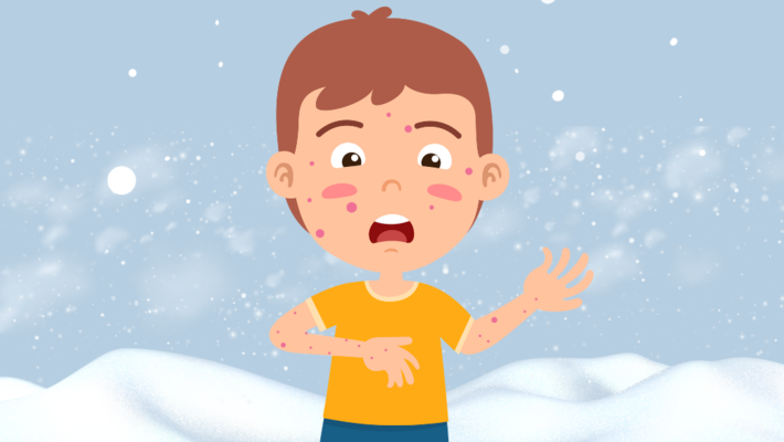 7 skin diseases to be careful of in winter
