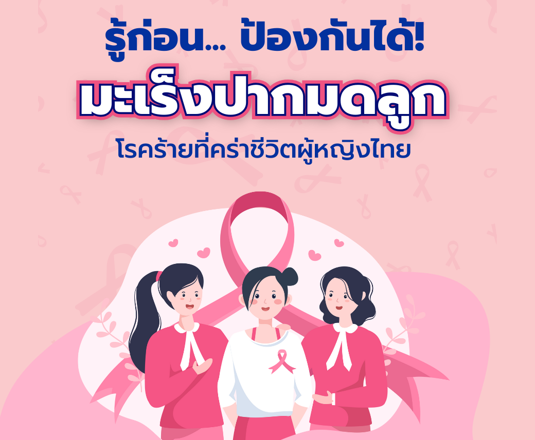 IG.png