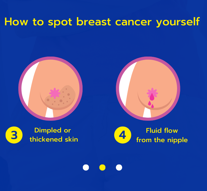 Top 90+ Images Photos Of Red Spots On Breasts Excellent