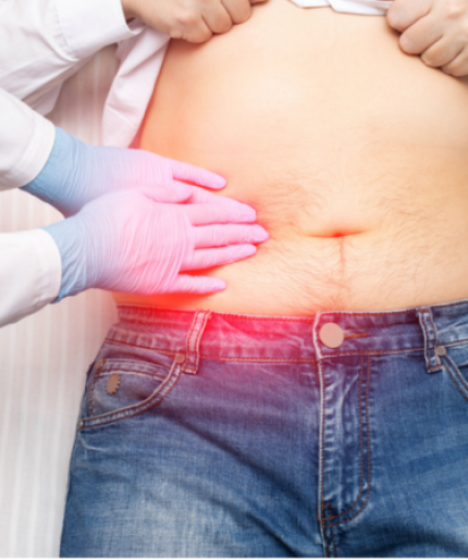 แพ็กเกจผ่าตัดถุงน้ำดีแบบส่องกล้อง สิทธิข้าราชการ