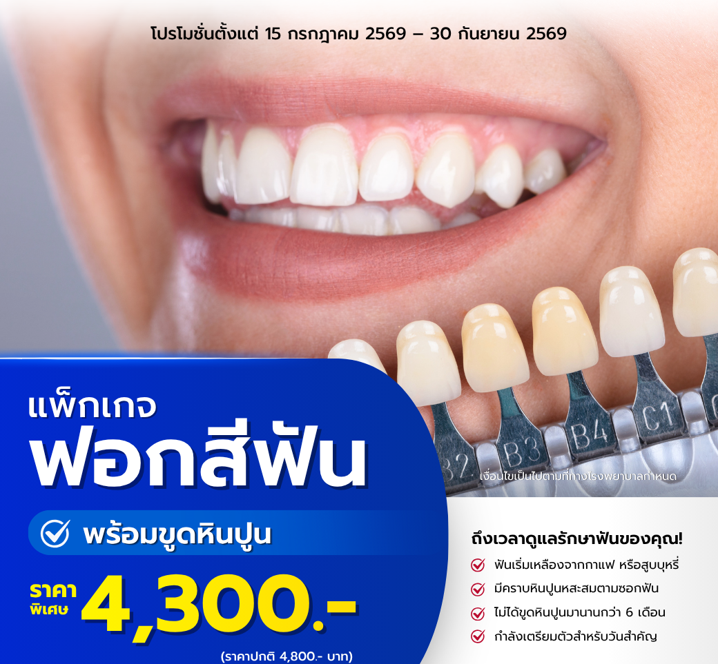 โปรโมชั่นฟอกสีฟันและขูดหินปูน.png
