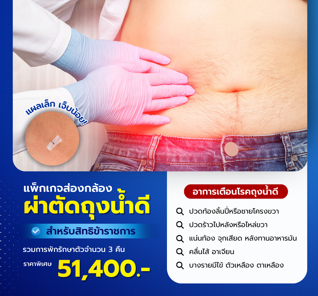 แพ็กเกจผ่าตัดถุงน้ำดีแบบส่องกล้องสิทธิข้าราชการ.png